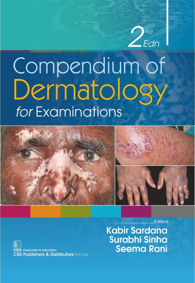 Compendium Of Dermatology For Examination 2Ed (Hb 2021) - SS Publishers ...